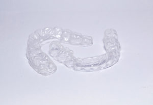 teeth whitening with invisalign, is not possible
