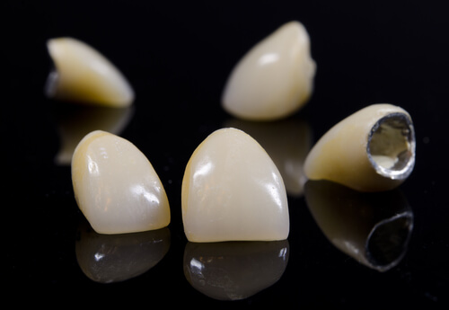 Dental Cement For Crowns: What Is This Glue Made Of?